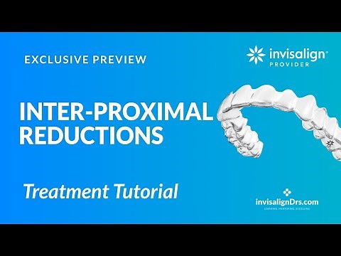 IPR with Invisalign Treatment