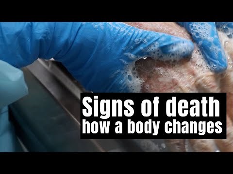 Changes that happen to a body after death