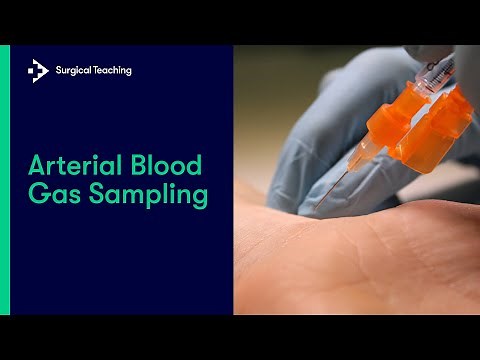 Arterial Blood Gas (ABG) Sampling | Everything You Need to Know to Perform this Vital Procedure
