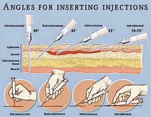 Safer injection guide