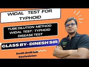 Widal test for typhoid | Tube dilution method widal test | Typhoid disease test