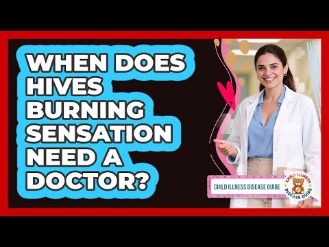 When Does Hives Burning Sensation Need a Doctor?