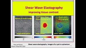 Amazing New Developments in Medical Ultrasound
