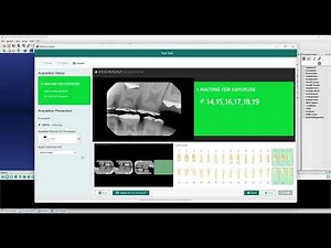 How to Use the DUO Sensor with Dentrix Imaging Software