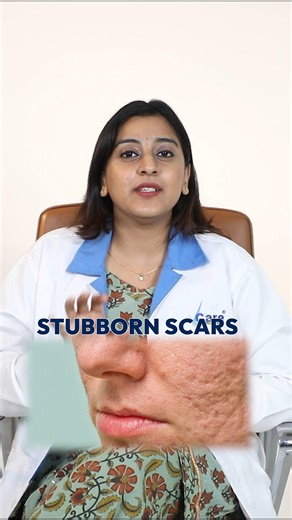 Makeup can hide scars, but what if you could truly heal them? Some...