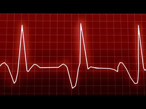 Heartbeat Sound Effect I Heartbeat Speeding Up Sound Effect | Slow To Fast