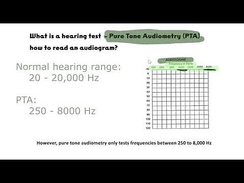 How to read an audiogram? What is Pure Tone Audiometry?
