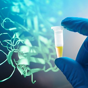 A Quick Guide to Magnetic Bead Extraction for Protein Isolation