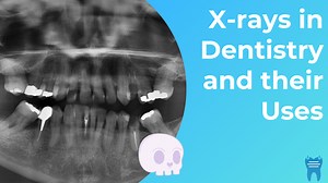Types of Dental Radiographs and their Uses - dentalnotebook