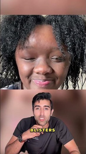 What Happens When Hair Dye Triggers an Allergic Reaction