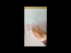 Volar cock up splint drawing