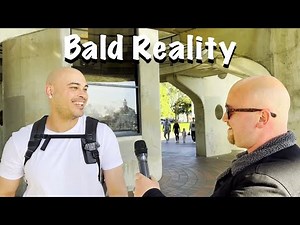 The Truth About Being Bald