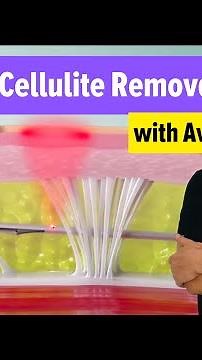 Aveli Cellulite Reduction