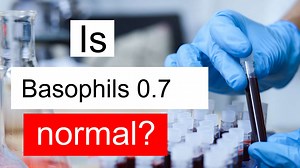 Is Basophils 0.7 normal, high or low? What does Basophils level 0.7 mean?