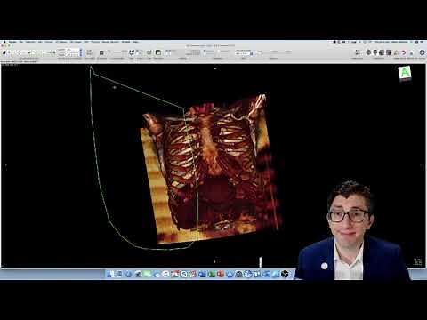 How-To: Creating a 3D Reconstruction of Your Patient's CT Scan