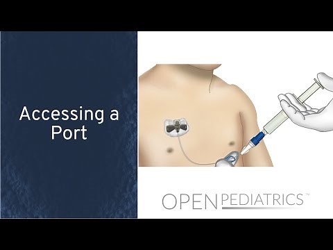 Accessing a Port by P. Dockx | OPENPediatrics