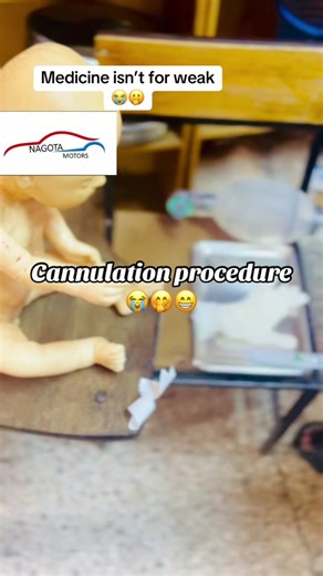 Cannulation Procedure Tips for Medical Students