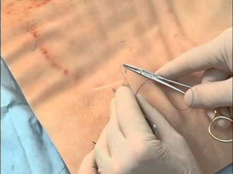 8 Common Suture Techniques for Skin Closure