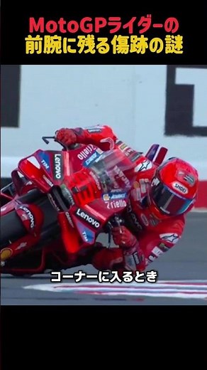 MotoGPライダーの前腕に残る傷跡の謎！