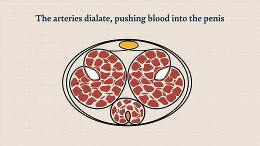 Giddy: Breakthrough Wearable ED Treatment