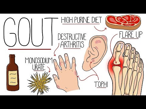 Understanding Gout (Gout Explained Clearly)