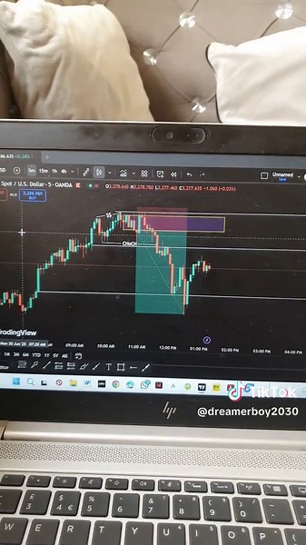 #trader #eritreantrader#thinker