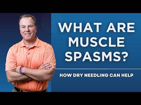 What Are Muscle Spasms? How Dry Needling Can Help