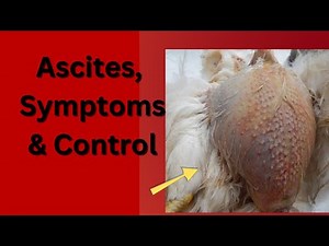 Understanding Ascites ( water belly), Symptoms & Control Tips