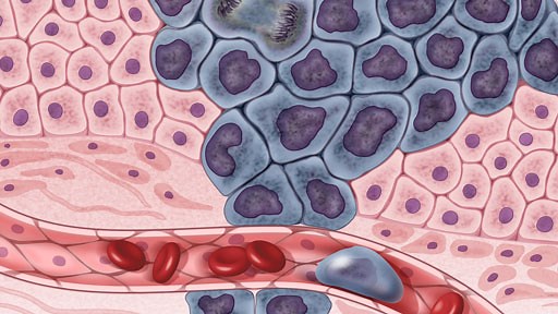 The Cancer Genome Atlas (TCGA)