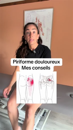 Je te donne les conseils pour soulager tes douleurs de piriforme dans la fesse : auto massage, étirement et focus sur le psoas en parallèle.
