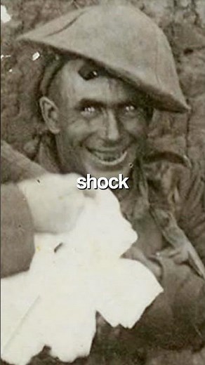 The truth behind the famous shell shock man…