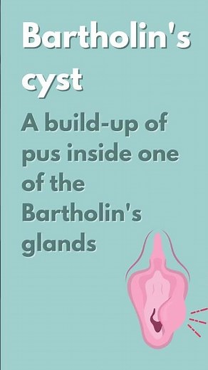 Types of abscesses #Shorts | UHL NHS Trust