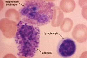 What Everyone Should Know About White Blood Cells
