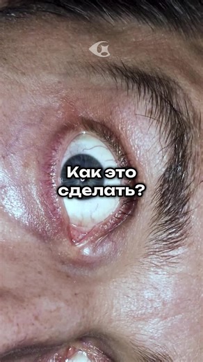 How to Rotate Your Eyes