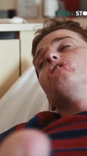 326K views · 3K reactions | A father's transformation through facial surgery profoundly affects his young son, creating emotional distance. He hopes that the surgery will bridge the gap and restore their close bond. Hopefully, it will make all the difference. #facialSurgery #fatherSon #emotionalJourney #family #transformation | Real Stories | Facebook