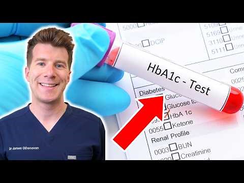 What Is a Hemoglobin A1c Test? How It Detects and Tracks Diabetes