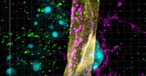 Learn how to detect objects in Imaris using the Spots model- Oxford Instruments