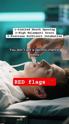 Difficult Airway: 30 Seconds That Can Save a Life #anesthesia #difficultairway #airwaymanagement