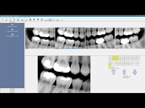 Eaglesoft Advanced Imaging Overview