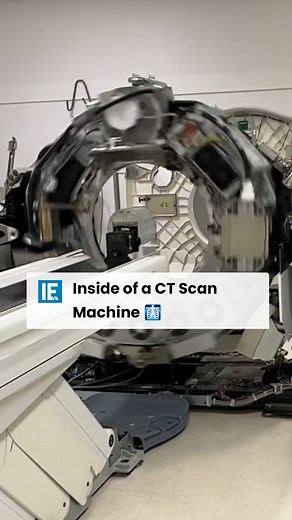 This Reddit user filmed a CT scan machine spin with no covers. That thing is spinning at a rate of 120 RPM. #ctscan #machine #spin #nocovers #120rpm #reddit #video | Interesting Engineering
