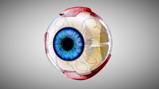 Signs of Retinal Detachment