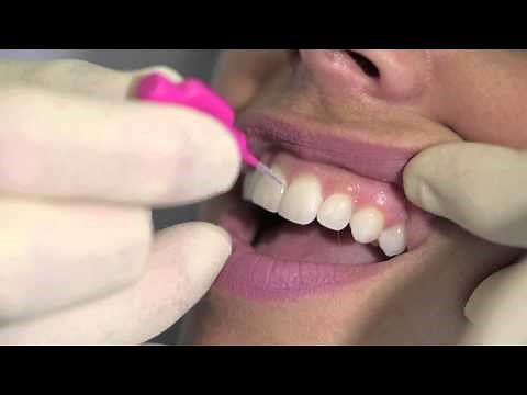 How to use an interdental brush - AJ Hedger