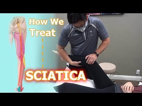 How We Treat Sciatica | Physical Therapy