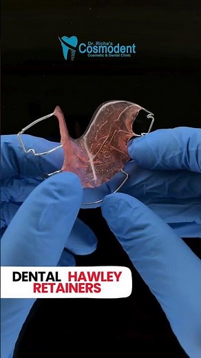 Removable Retainer After Braces | Hawley Retainer Explained by Dr. Richa Mehta | Richa’s Cosmodent