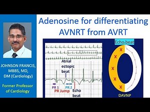 Adenosine for differentiating AVNRT from AVRT