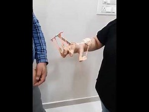 Dynamic Cockup Hand Splint Finger Extension For Paralysis & Stroke Patients-Salo Orthotics