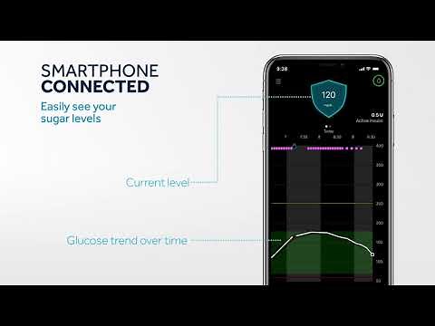 MiniMed 770G System – New Diabetes Management Technology from Medtronic