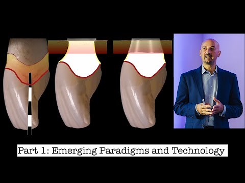 Could the implant selection and the prosthetic design predispose to peri-implantitis? (1/4)