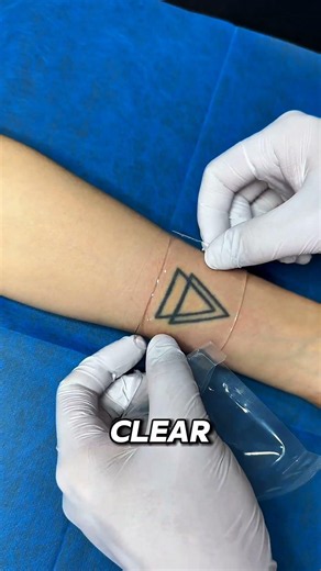 The Secret to Fast Laser Tattoo Removal 😳
