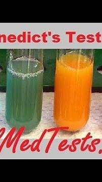 stool for reducing substance,stool reducing sugar test,benedict's test for reducing sugar#viral